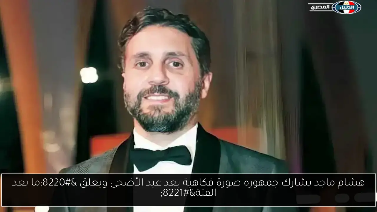 هشام ماجد يشارك جمهوره صورة فكاهية بعد عيد الأضحى ويعلق “ما بعد الفتة”